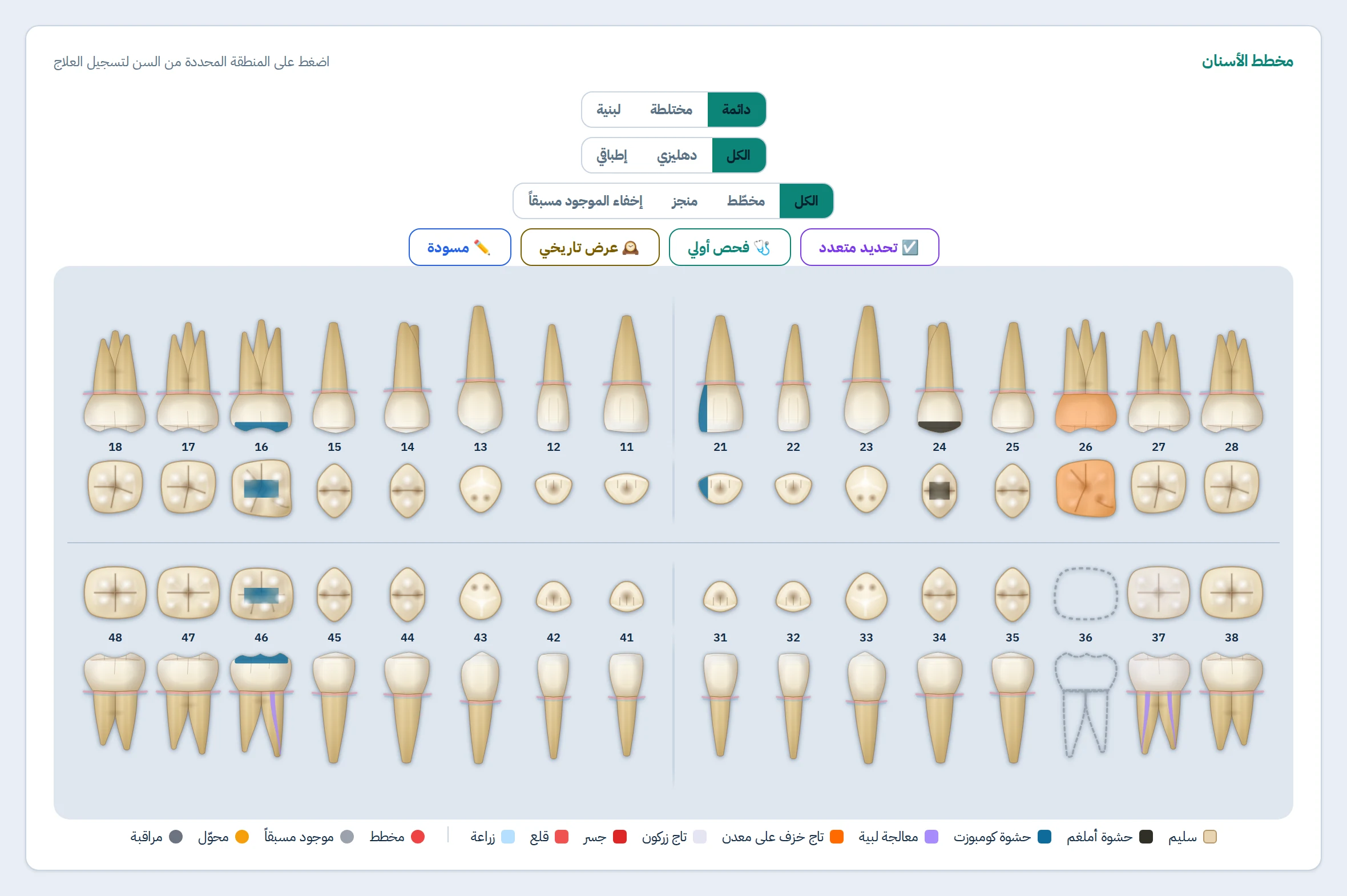 مخطط الأسنان في SyDent — لقطة من التطبيق: المنظر الدهليزي والإطباقي مع العلاجات المسجَّلة